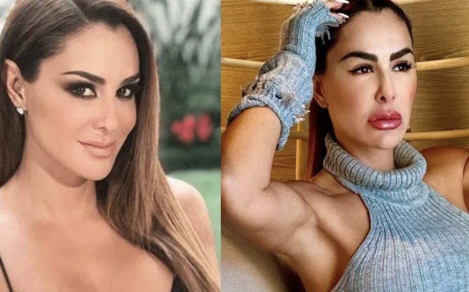 NINEL CONDE LUCE IRRECONOCIBLE TRAS MÚLTIPLES CIRUGÍAS PLÁSTICAS